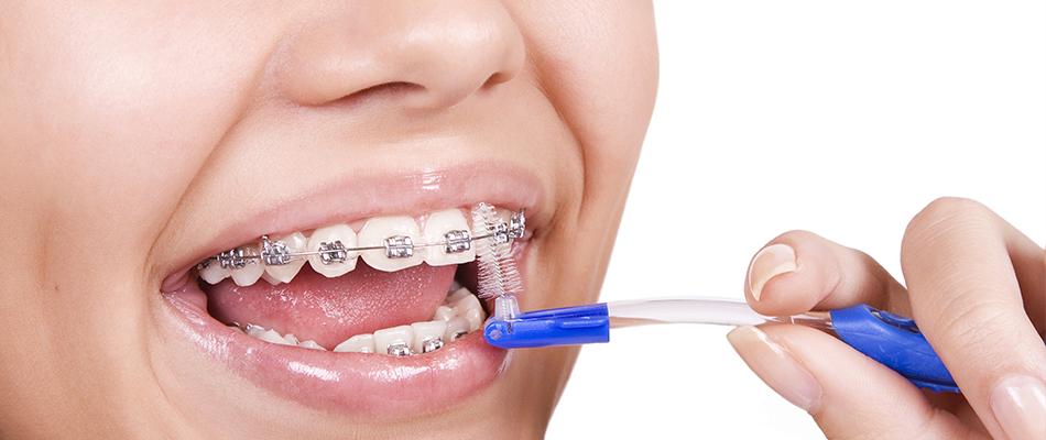Что такое ортодонтия?